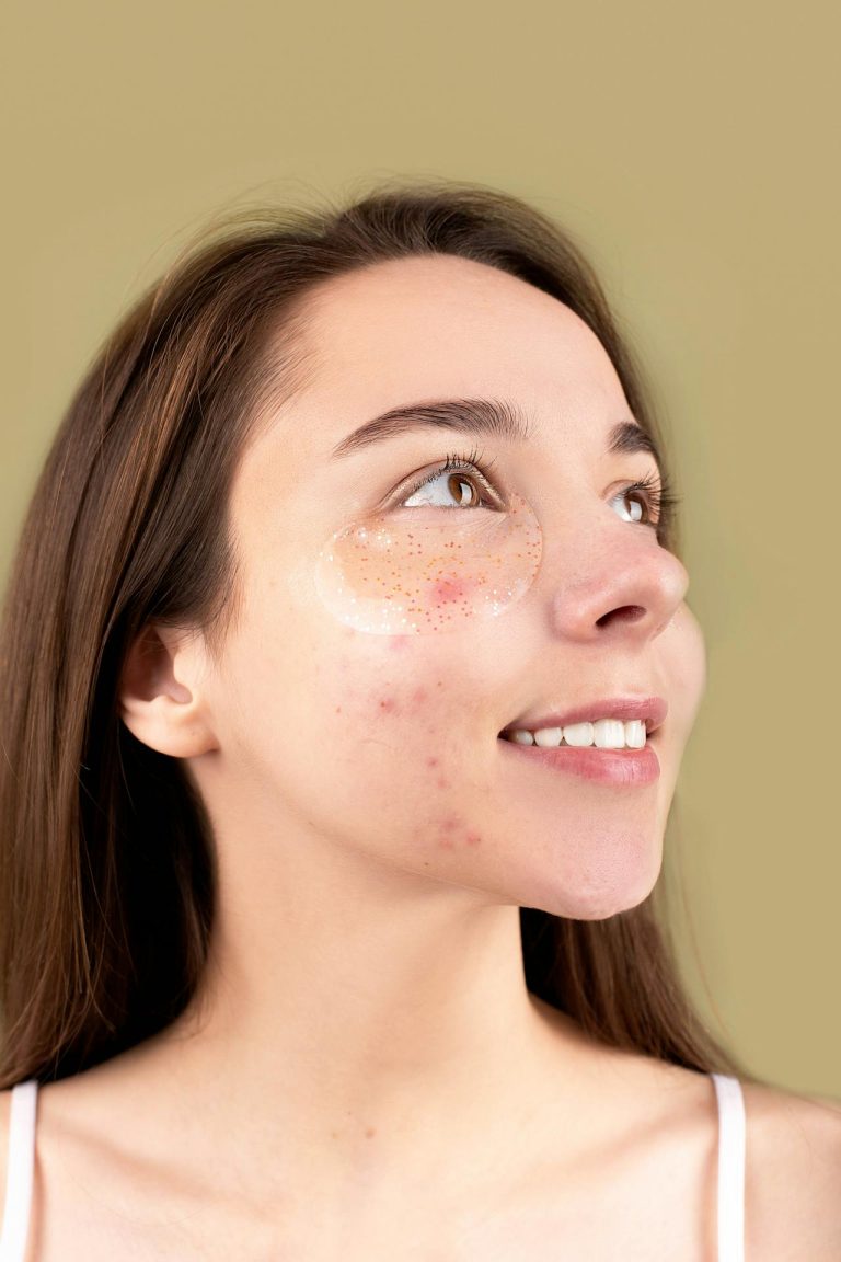 best ways to reduce acne scars at home
